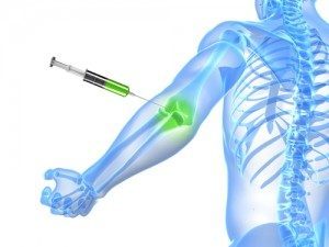 prolotherapy bend oregon