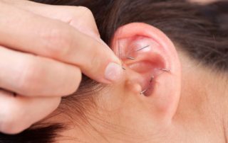 November Class (Full) - Experience Auricular Acupuncture 6 ear acupuncture