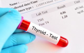 Thyroid Awareness Month -- January 2021 6 thyroid test