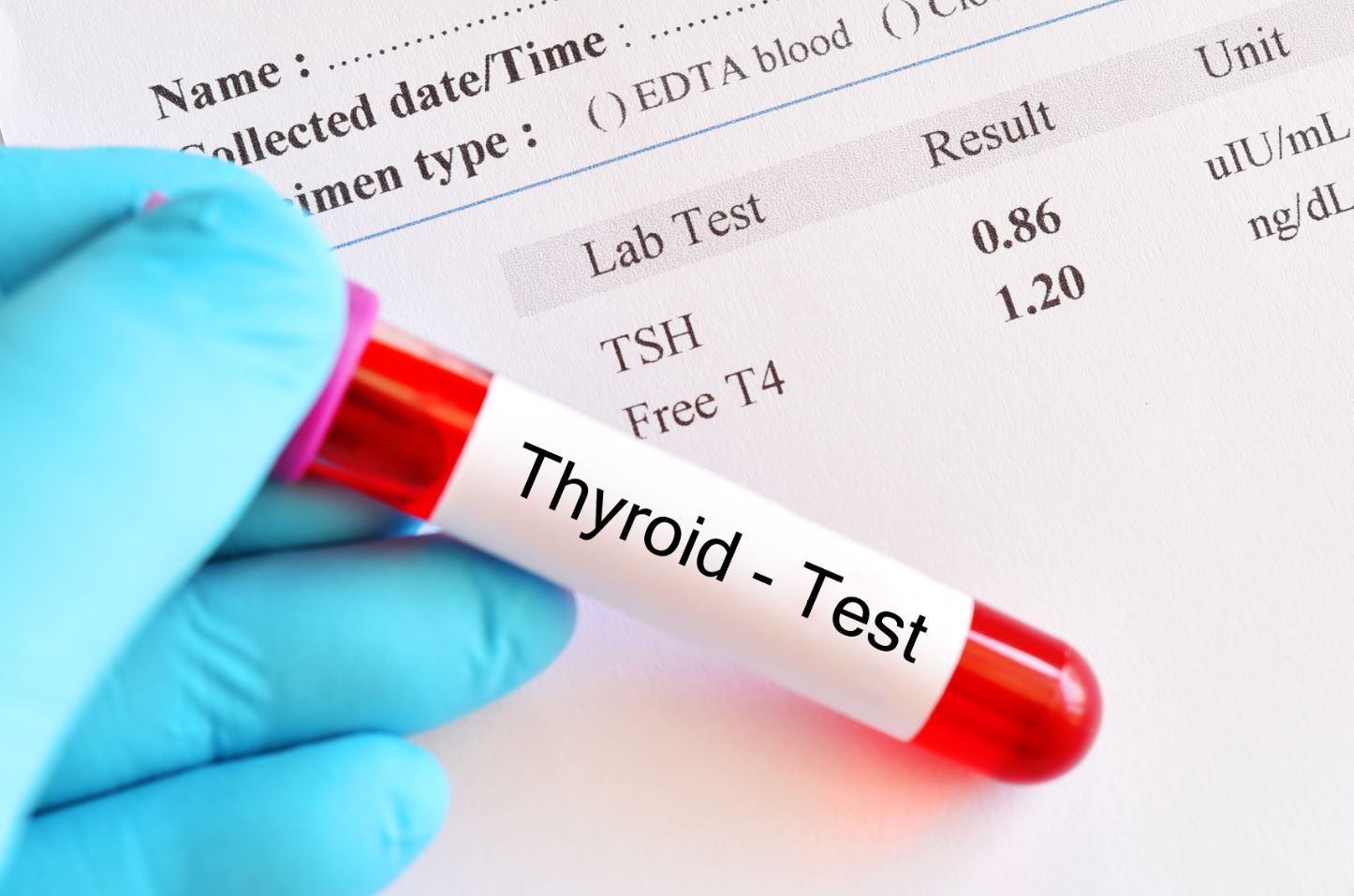 thyroid test
