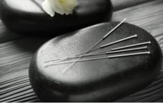 Acupuncture. Bend Oregon
