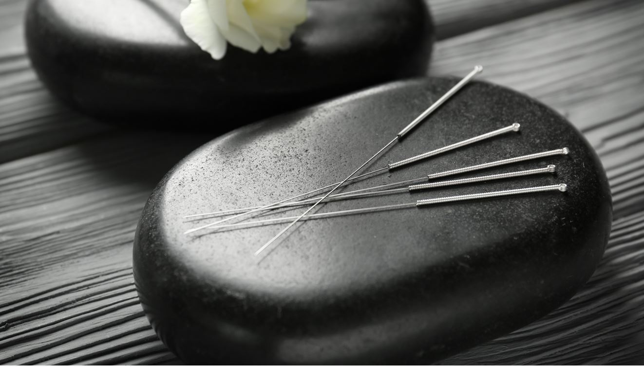 Acupuncture. Bend Oregon