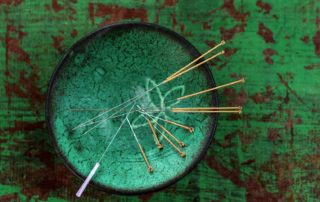 Community Style Acupuncture