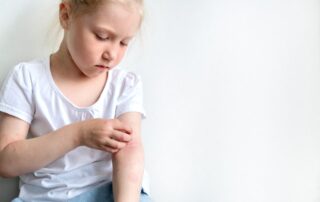 Childhood Eczema: Looking Beneath the Surface to Support Healing 4 Eczema can be frustrating and exhausting—for children and parents alike. The itching can disrupt sleep, impact mood, and leave families feeling like they are constantly trying one cream after another. The encouraging news is that eczema often improves significantly when underlying triggers are identified and addressed. For many children, dietary sensitivities resolve as they grow older and their digestive and immune systems mature.