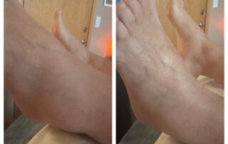 Manual Lymphatic Drainage MLD 2